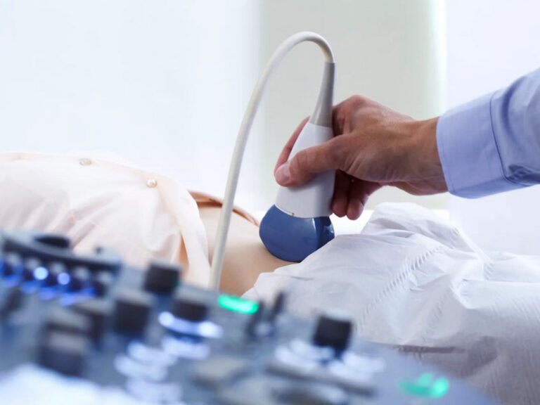 Doctor performs a sonogram